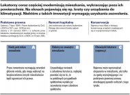 Czego wymaga zabudowa balkonu, wstawienie krat...