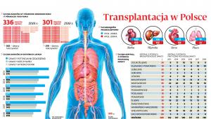 Transplantacja w Polsce
