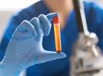 Badania kliniczne produktów leczniczych. Ustawa może wejść w życie już w przyszłym roku