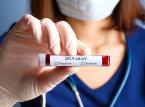 Koronawirus straszy podatników. Będzie specustawa o pomocy przedsiębiorcom