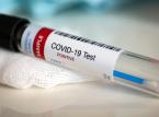 KLRwP: Lekarze POZ będą diagnozować COVID-19 w oparciu o wiedzę medyczną, a nie sztywne przepisy
